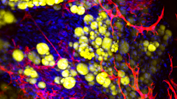 Adipocyte_tissu_adipeux_exvivo_©LaboratoireRestore_vignette