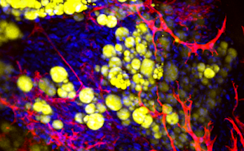 Adipocyte_tissu_adipeux_exvivo_©LaboratoireRestore_vignette