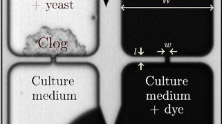 (Bio)filtration-on-chip, or how to study microscale filtration mechanisms.